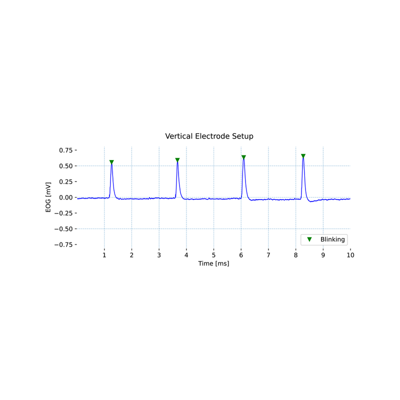 Electrooculography (EOG) Sensor Signal sample 