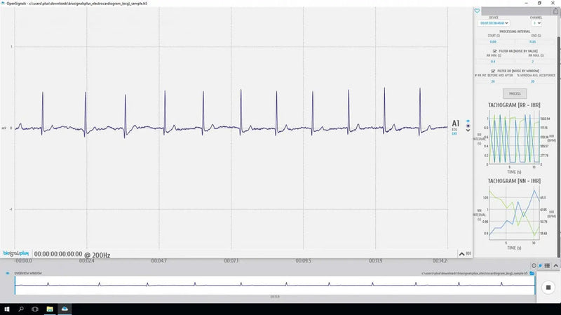 Heart Rate Variability (HRV) Add-on