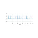 Electrocardiography (ECG) Sensor Signal sample