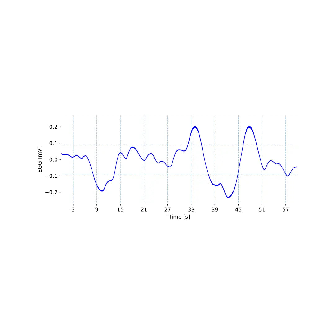 Electrogastrography (EGG) Sensor Signal sample