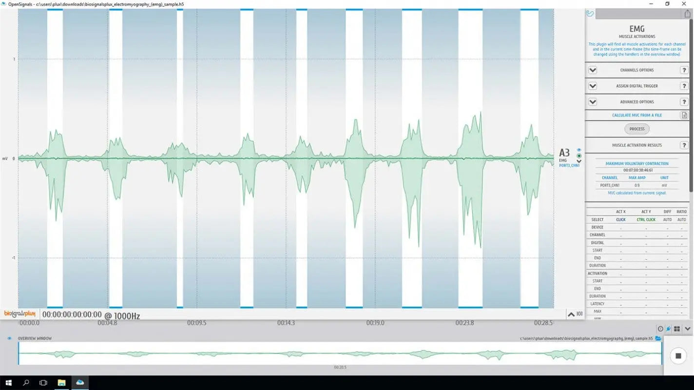 Coding Emg Examples PLUX Biosignals | Electromyography (EMG) Analysis Add-on